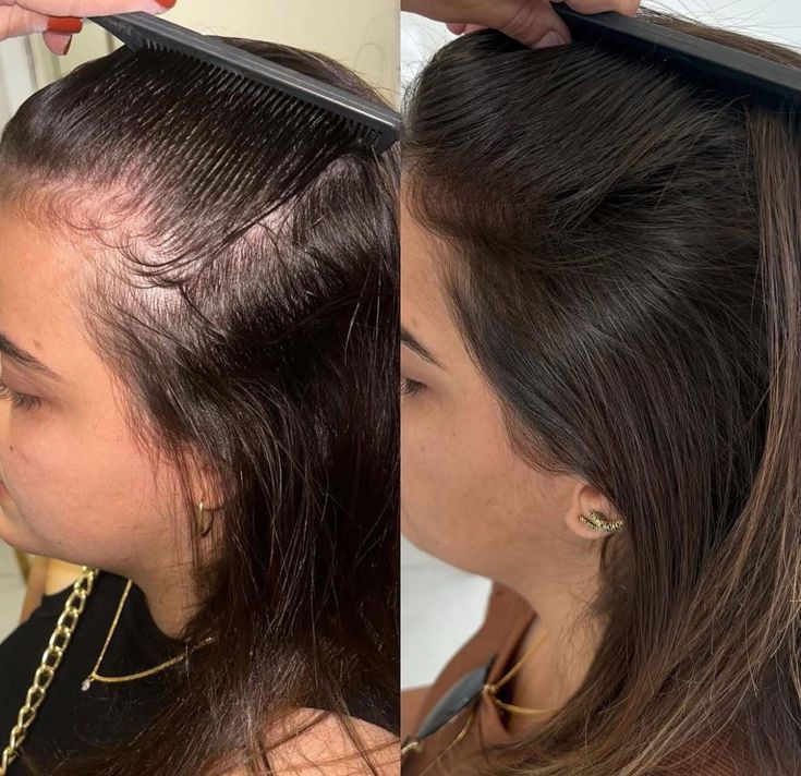 Cabelo antes e depois