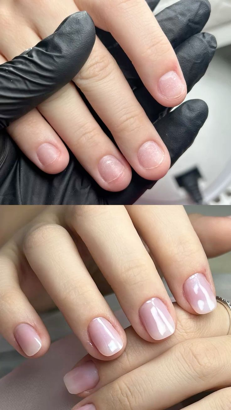 Unhas antes e depois